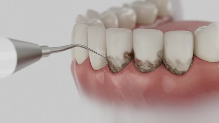 Reliable Dental Implants contractor in Highland, CA by Smile Center Dentistry